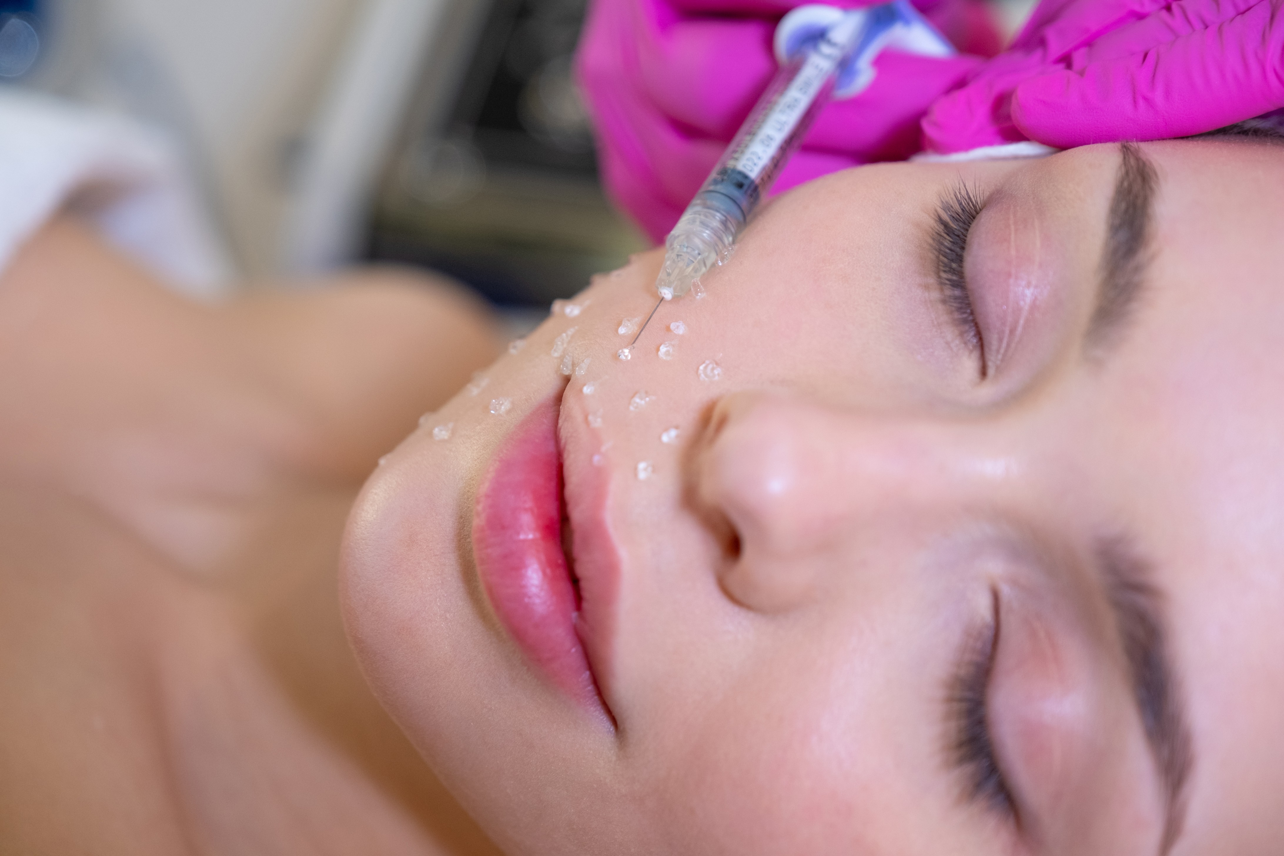 Woman getting hyaluronic acid facial injection