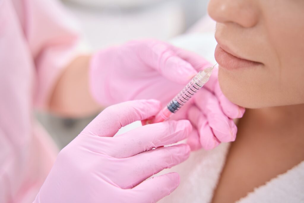 Lip filler injection by medical professional